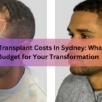 Hair Transplant Costs In Sydney What to Budget for Your Transformation