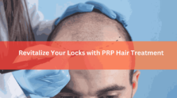 Revitalize Your Locks with PRP Hair Treatment