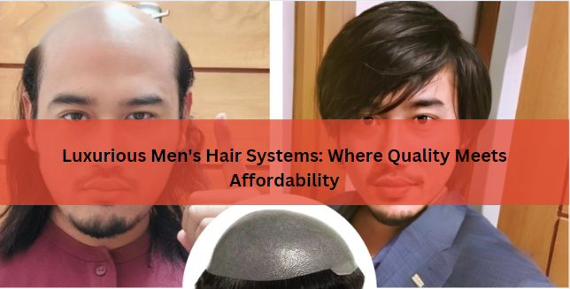 Luxurious Men's Hair Systems: Where Quality Meets Affordability