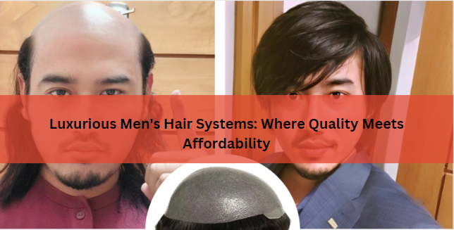 Luxurious Men’s Hair Systems: Where Quality Meets Affordability