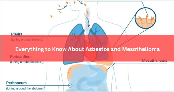 Everything to Know About Asbestos and Mesothelioma