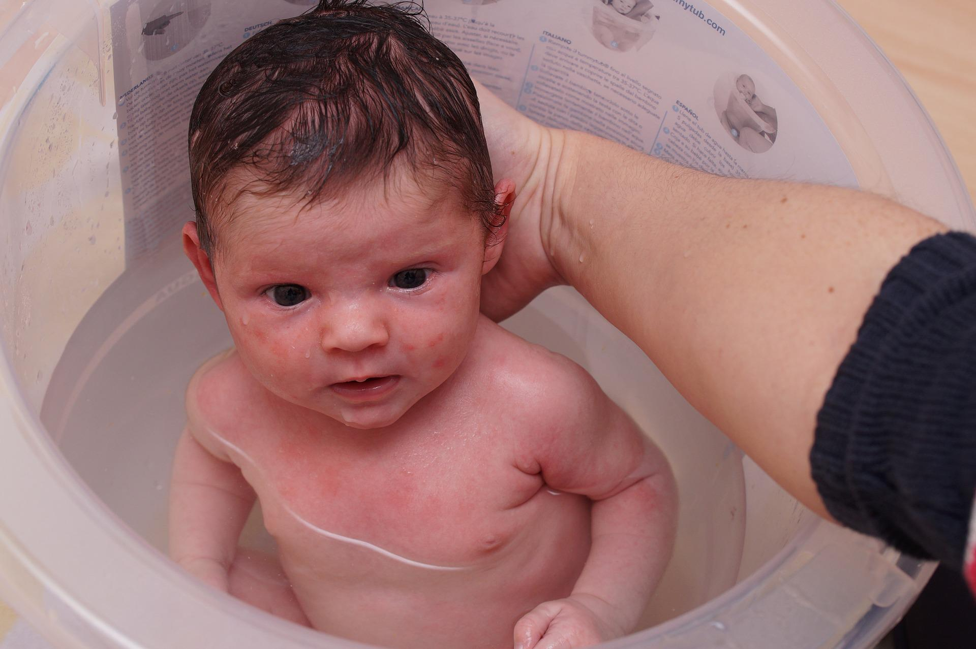 Eczema Management Starts with the Right Bath Routine for Your Baby