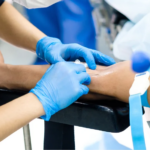 How Hand Surgery Restores Function After Traumatic Injuries