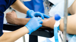 How Hand Surgery Restores Function After Traumatic Injuries