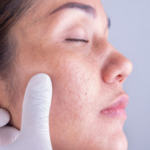 The Role of a Dermatologist in Maintaining Healthy Skin