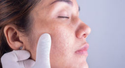 The Role of a Dermatologist in Maintaining Healthy Skin