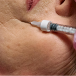 The Benefits of Botox for Preventing Fine Lines and Wrinkles