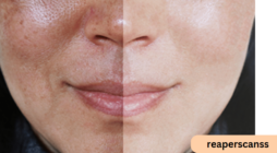 How Skin Rejuvenation Can Help With Sun Damage This Summer