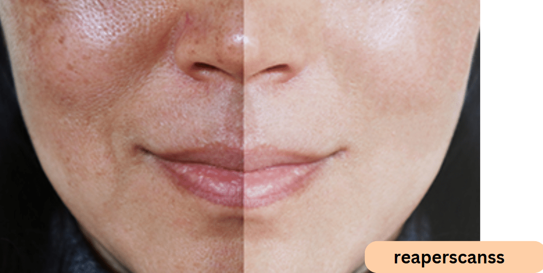 How Skin Rejuvenation Can Help With Sun Damage This Summer