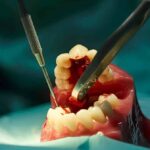 How Emergency Dentists Provide Immediate Care for Tooth Injuries