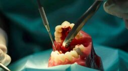 How Emergency Dentists Provide Immediate Care for Tooth Injuries