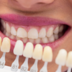 The Importance of Regular Teeth Whitening Treatments