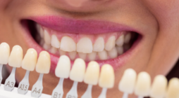 The Importance of Regular Teeth Whitening Treatments