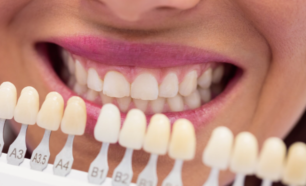 The Importance of Regular Teeth Whitening Treatments