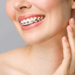 A Complete Guide to Modern Braces Options in Winnipeg