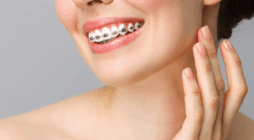 A Complete Guide to Modern Braces Options in Winnipeg