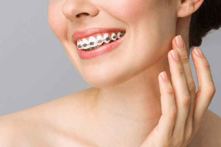 A Complete Guide to Modern Braces Options in Winnipeg