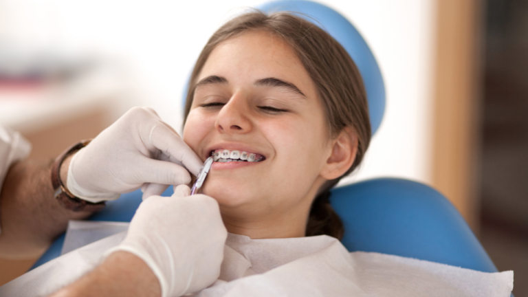 Who Needs Braces Treatment? A Complete Easy Guide
