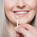 How Does a Cosmetic Dentist Place Crowns and Veneers?