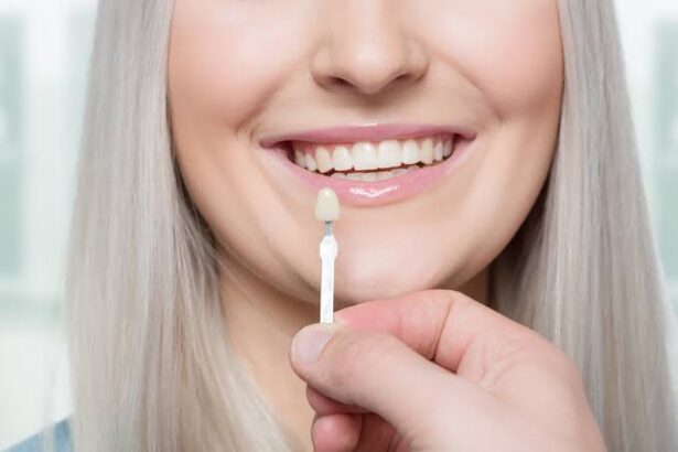 How Does a Cosmetic Dentist Place Crowns and Veneers?
