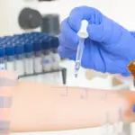 The Future of Allergy Testing